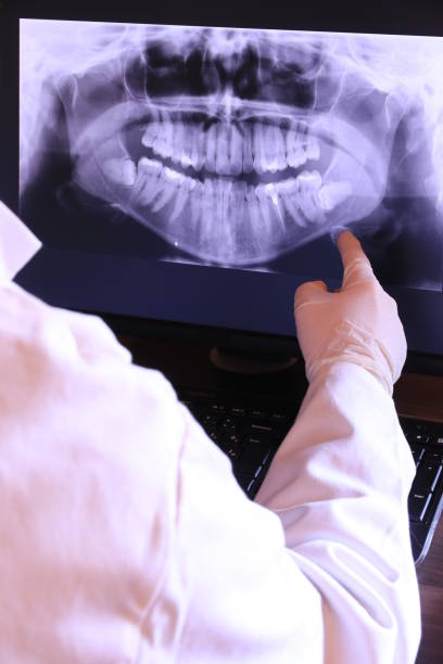 Best Emergency Root Canal Treatment in Ridgefield Park, NJ